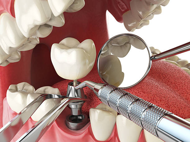 Best Emergency Root Canal Therapy in Tanque Verde, AZ